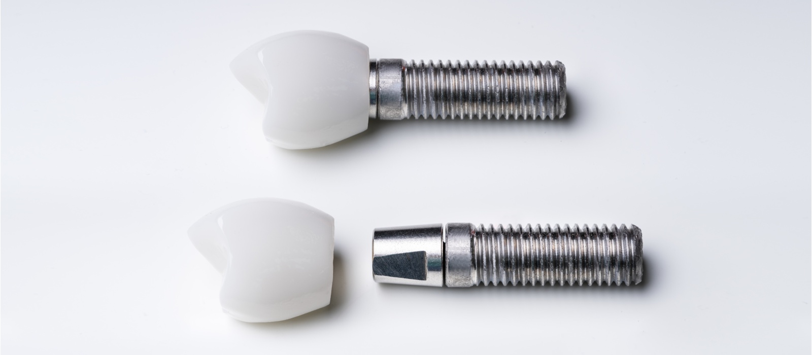 Dental Implants Image