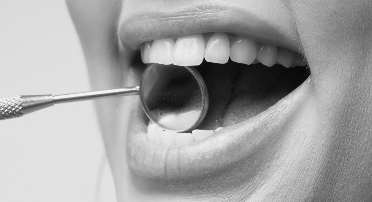 General-preventive-Dentistry Image